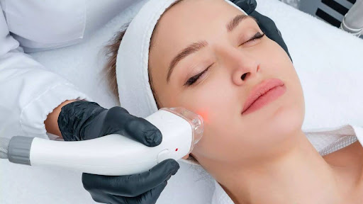 RF Microneedling Boynton Beach